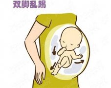 临产前宝宝脐带绕颈胎死腹中,准妈你注意胎动了