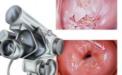 宫颈检查项目有哪些 做宫颈检查的价格